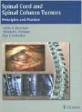 Spinal Cord and Spinal Column Tumors: Principles and Practice