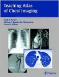 Teaching Atlas of Chest Imaging