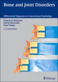 Bone and Joint Disorders