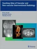 Teaching Atlas of Vascular and Non-Vascular Interventional Radiology
