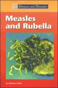 Measles And Rubella