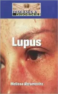 Lupus