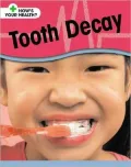 Tooth Decay