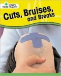 Cuts, Bruises, and Breaks