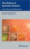 The Retina in Systemic Disease: A Color Manual of Ophthalmoscopy