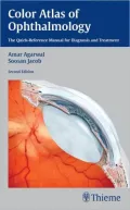 Color Atlas of Ophthalmology: The Quick-Reference Manual for Diagnosis and Treatment