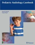 Pediatric Audiology: Diagnosis, Technology, and Management (Book and DVD)