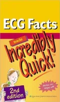 ECG Facts