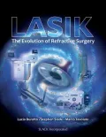 Lasik