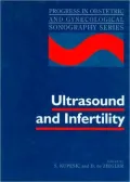 Ultrasound and Infertility