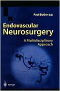 Endovascular Neurosurgery