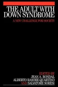 Adult with Down Syndrome: A New Challenge for Society