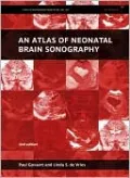 An Atlas of Neonatal Brain Sonography