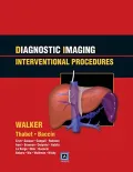 Diagnostic Imaging: Interventional Procedures: Published by Amirsys