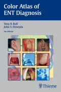 Color Atlas of Ent Diagnosis