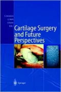 Cartilage Surgery and Future Perspectives