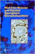 Mad Cow Disease and Related Spongiform Encephalopathies