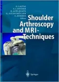 Shoulder Arthroscopy and MRI Techniques