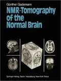NMR-Tomography of the Normal Brain