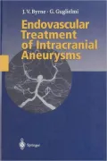 Endovascular Treatment of Intracranial Aneurysms