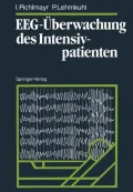 Eeg-Uberwachung Des Intensivpatienten
