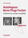 Autologous Bone Plugs Fusion: Treatment for Lumbar Instability