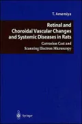 Retinal and Choroidal Vascular Changes and Systemic Diseases in Rats: Corrosion Cast and Scanning Electron Microscopy