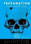 Trepanation History, Discovery, Theory